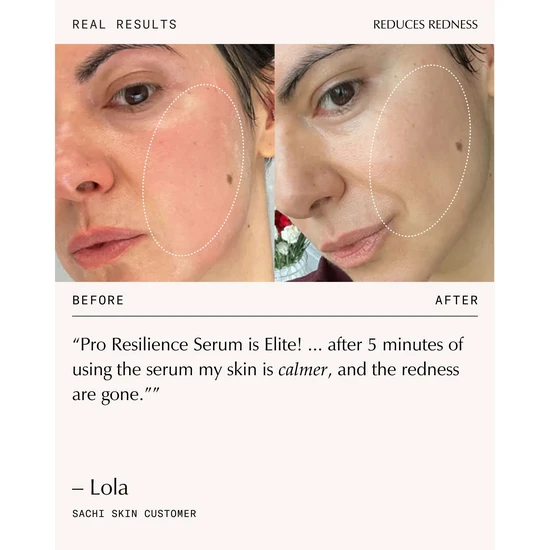 Sachi Skin Peptide Pro Resilience Serum Concentrate 30ml