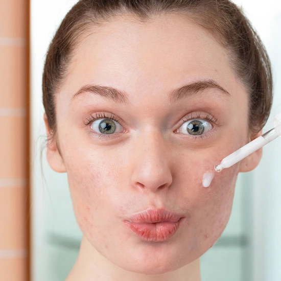 SVR SEBIACLEAR Ampoule Flash Azelaic Acid Anti-Blemish Concentrate