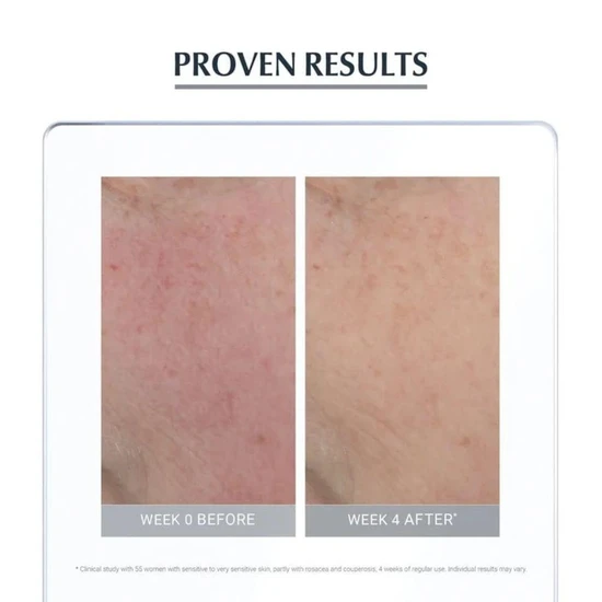 Eucerin Anti Redness Concealing Day Cream 50ml