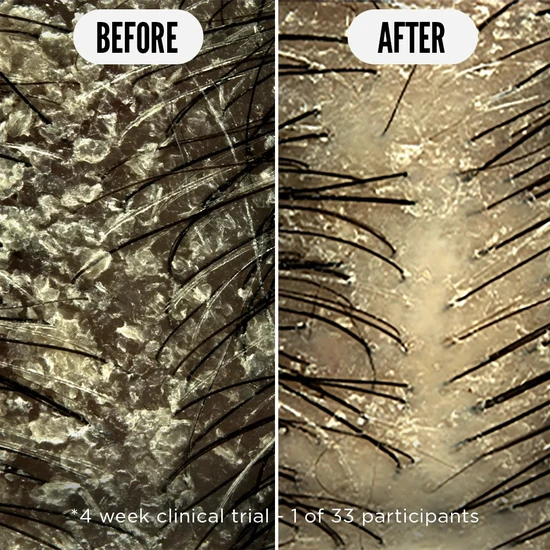 Noughty Care Taker Scalp Tonic 75ml