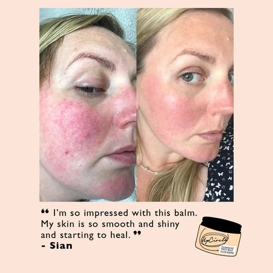 UpCircle Beauty Cleansing Face Balm With Apricot Powder 20ml