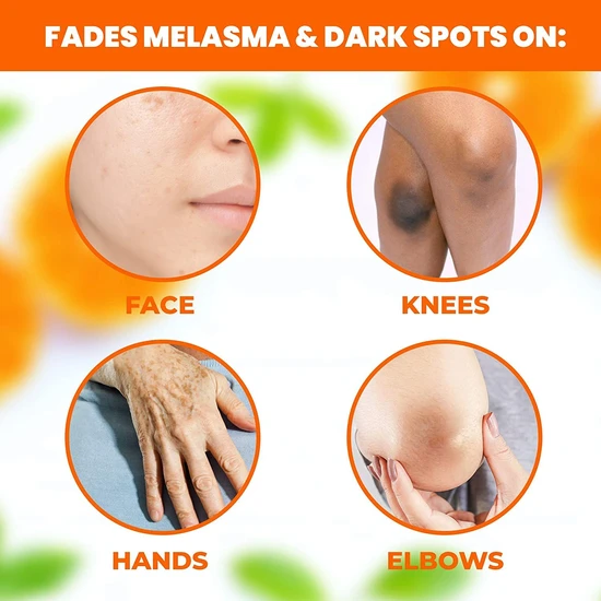 Mitchell Neoprosone Brightening Serum 30 ml