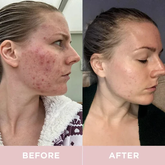 Revive Collagen Hydrolysed Marine Collagen Drink 14 Days