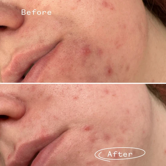 Pai Phaze Rebalancing PHA Cleanser 28ml