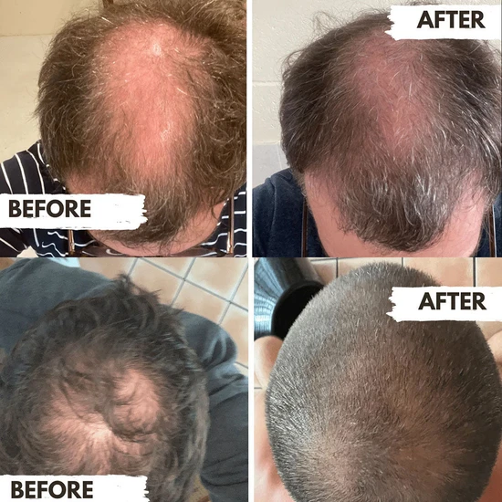 Regrow Shampoo For Men 300ml