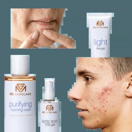 MG Skincare PURIFYING FACE TONER 100ml