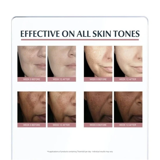 Eucerin Anti-Pigment Day Cream SPF 30 50ml