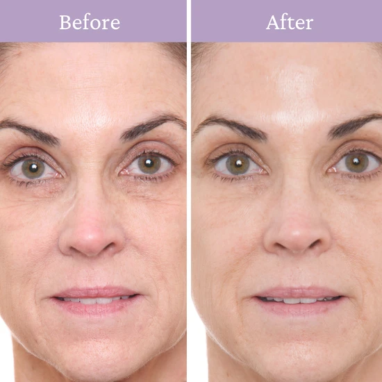 PRAI 24k Gold Concentrate Retinol+ 30ml