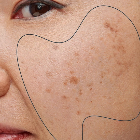 Dermalogica PowerBright Dark Spot Serum 30ml