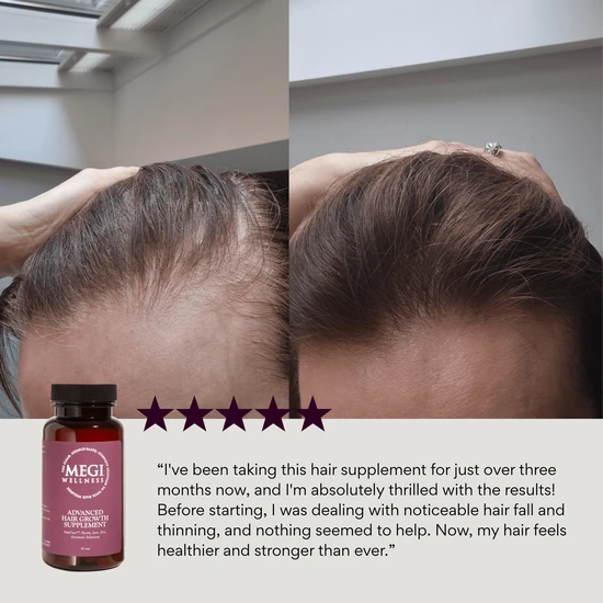 MEGI Wellness Advanced Hair Growth Supplement 60 Capsules