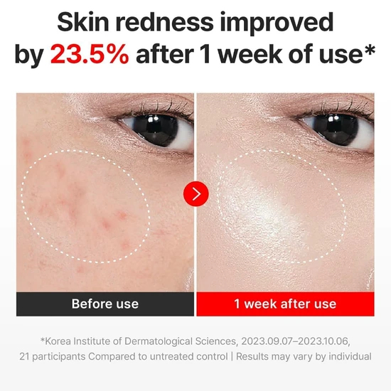 Centellian24 Madeca Time Reverse Face Cream 15ml