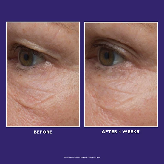 Peter Thomas Roth Ultimate Solution 5 Multitasking Eye Cream