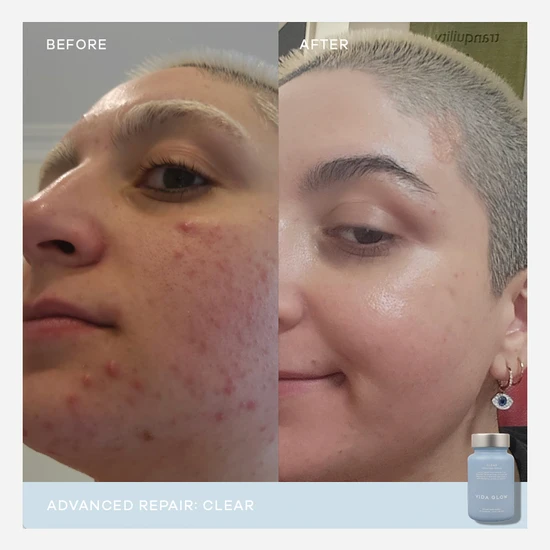 Vida Glow Clear Advanced Repair x 30