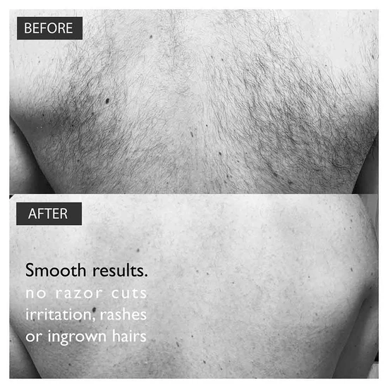 Baldape Parlour Back & Body Hair Removal The Silverback Kit