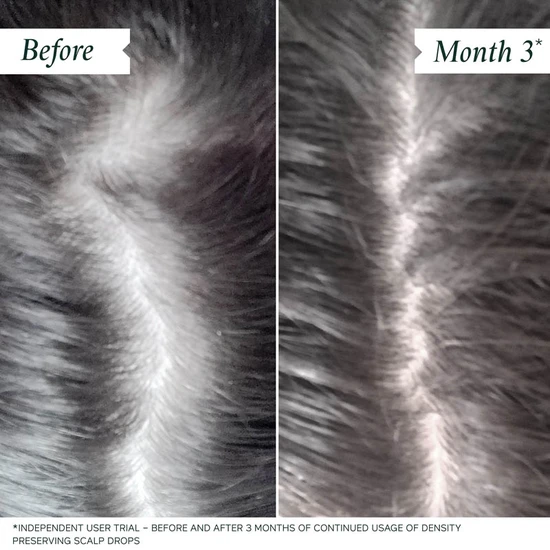 Philip Kingsley Density Preserving Scalp Drops 85ml