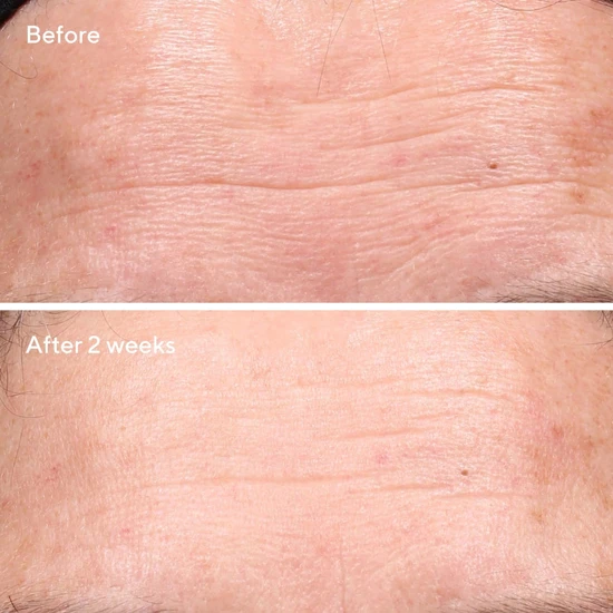 Murad Retinol Youth Renewal Serum 30ml