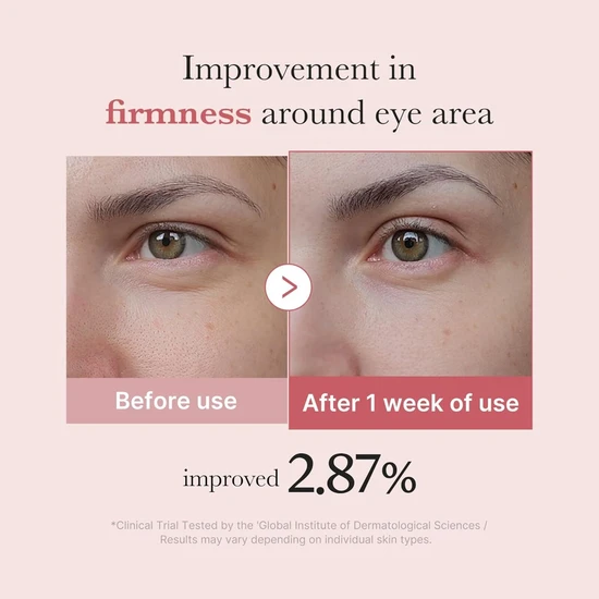 Medicube PDRN Pink Peptide Eye Cream 30ml