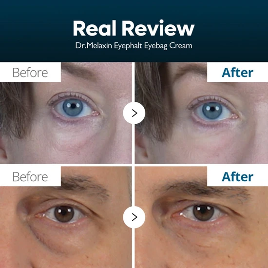 Dr.Melaxin Eyephalt Eyecream For Eyebags 10ml