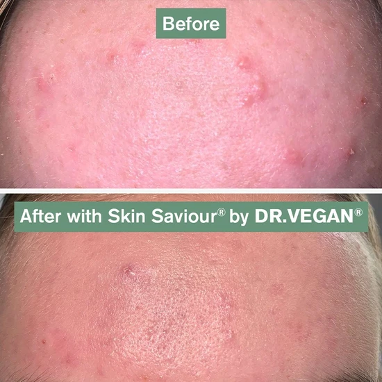 Dr Vegan Skin Saviour Capsules 60 Capsules