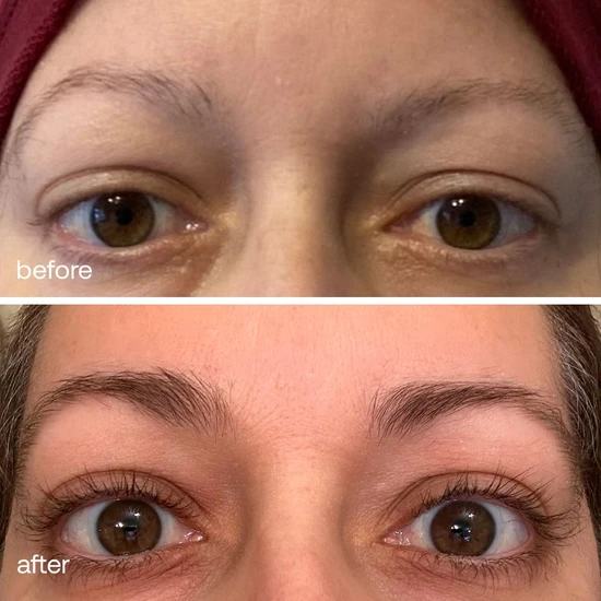 Uklash Eyebrow Serum For Fuller & Thicker Eyebrows
