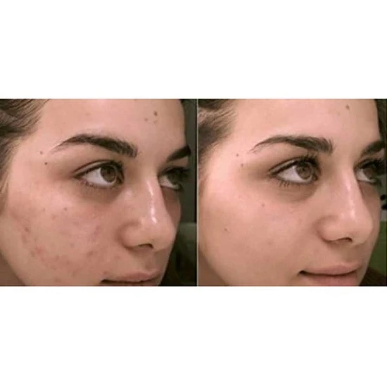 First Lady Fast Actives Lemon Skin Beautifying Soap 200g