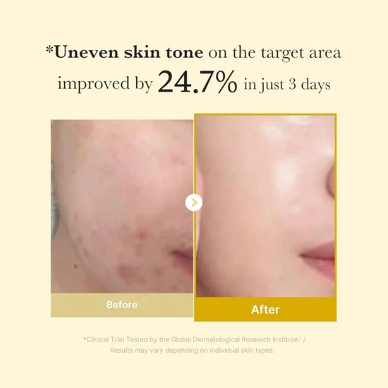 Medicube Kojic Acid Turmeric Night Wrapping Mask 75ml