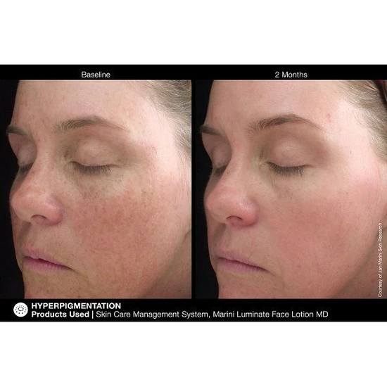 Jan Marini Luminate Face Lotion 30ml