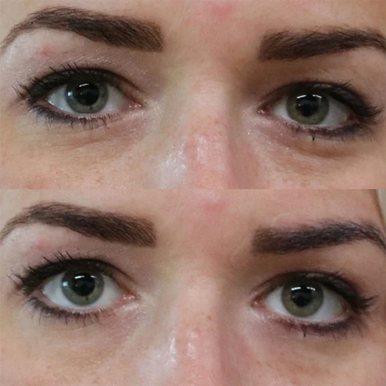 Smile Science Harley Street D-Crease Rapid Wrinkle Reduction Cream 12ml