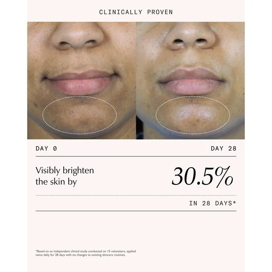 Sachi Skin Triphala Pigmentation Corrector 30ml