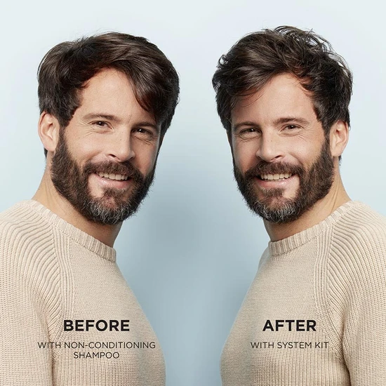 Nioxin System 1 Scalp Therapy Revitalising Conditioner For Natural Hair With Light Thinning 300ml