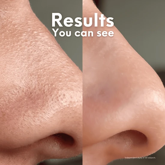 Skin Choice Breakout Patch Classic Nose