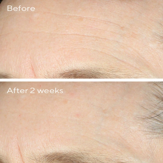 Murad Intense Recovery Cream 50ml