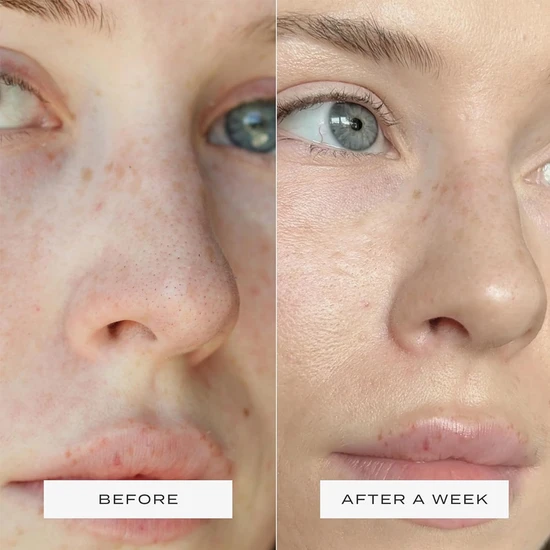 Vue Salicylic Acid Exfoliant 110ml