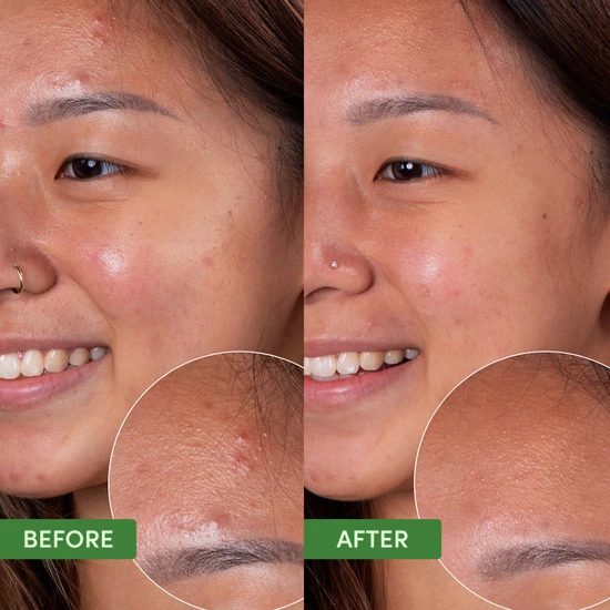 Sand & Sky Oil Control Clearing Face Mask 100g