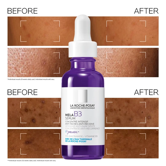 La Roche-Posay Mela B3 Serum 50ml