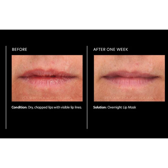 PCA SKIN Overnight Lip Mask