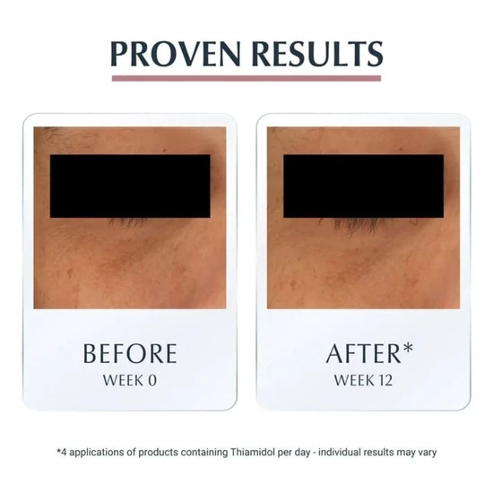 Eucerin Anti-Pigment Dark Circle Eye Treatment 15ml