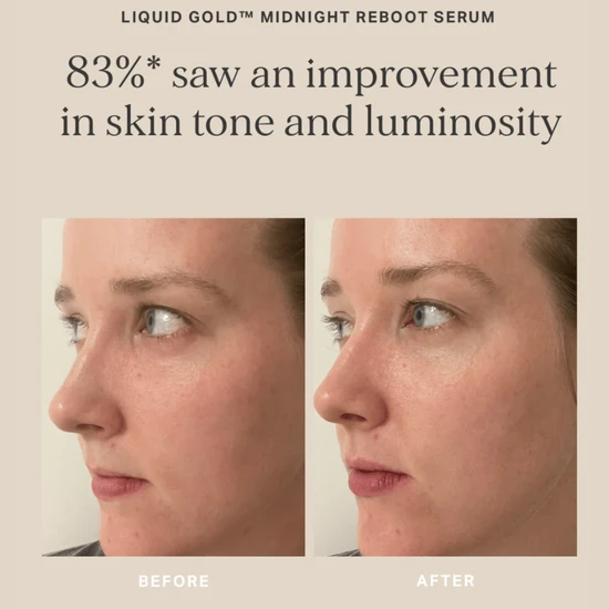 Alpha-H Liquid Gold Midnight Reboot Serum 50ml