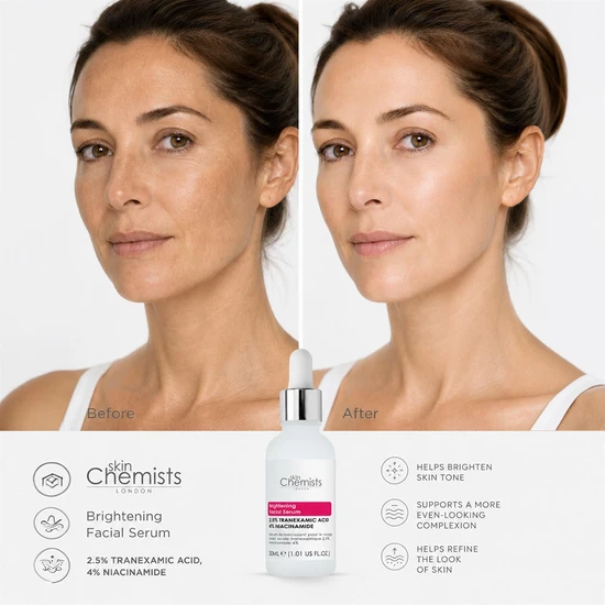 skinChemists Brightening Facial Serum With Tranexamic Acid 2.5% & Niacinamide 4% 30ml