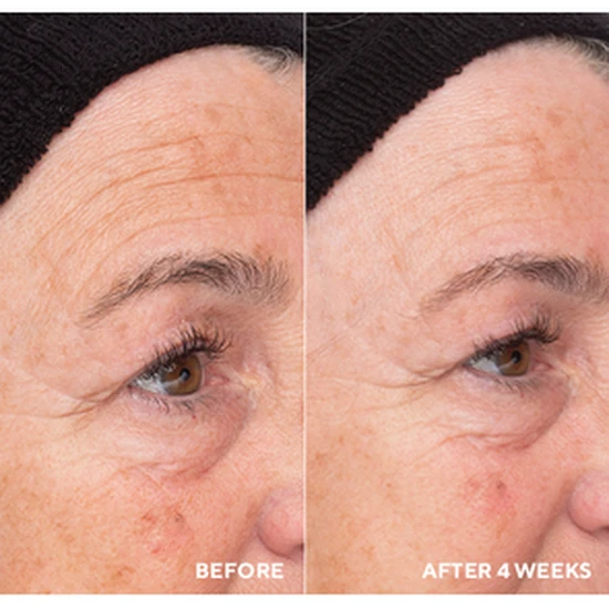 HydroPeptide Liquid Resurfacing Solution 120ml