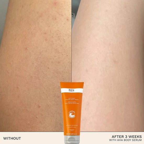 REN AHA Smart Renewal Body Serum