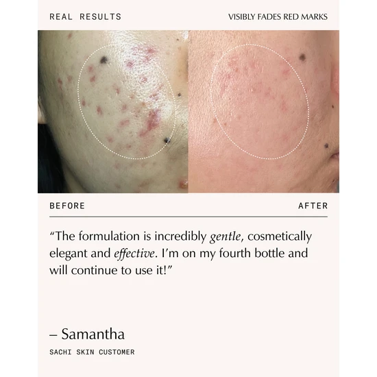 Sachi Skin Triphala Pigmentation Corrector 30ml