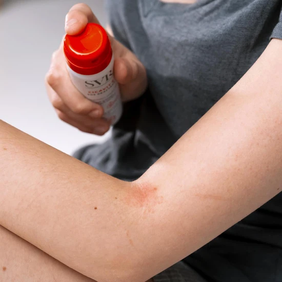 SVR CICAVIT+ SOS Anti-Itch Spray 40ml