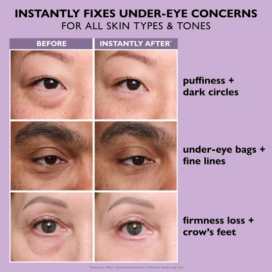 Peter Thomas Roth Instant FIRMx Eye Temporary Eye Tightener Easy-Wear Formula 20ml