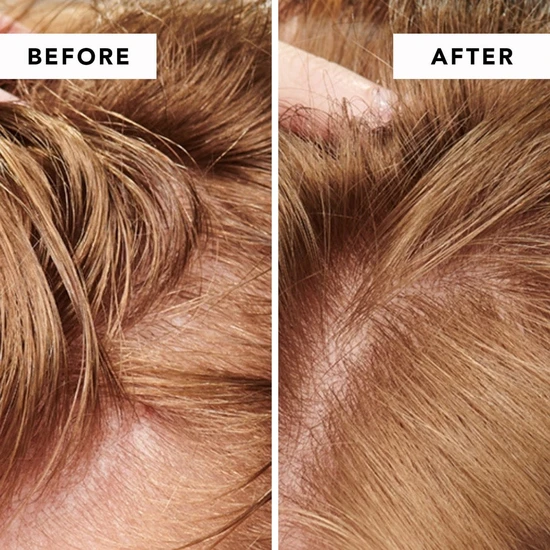 WE ARE PARADOXX Detox Dry Shampoo 50g