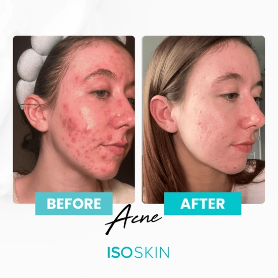 ISOCLEAN ISOSKIN Hypochlorous Spray 275ml