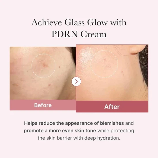 Medicube PDRN Pink Hyaluronic Moisturising Cream 50ml