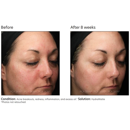 PCA SKIN HydraMatte