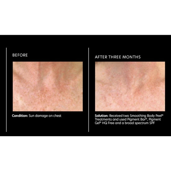 PCA SKIN Body Treatments Pigment Bar 90g