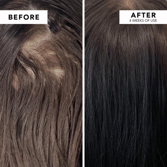 WE ARE PARADOXX Growth Accelerate Advanced Scalp Serum 50ml